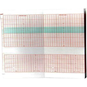 Fetal Diagnostic Monitor Recording Paper Edan   Thermal Paper 90 mm X 152 mm Roll Red Grid