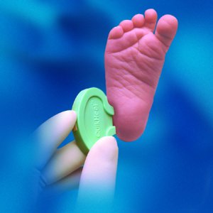 Pediatric Lancet BD Microtainer    Incision Device Blade 1.0 mm X 2.5 mm Depth 2.5 mm Blade Push Button Activation