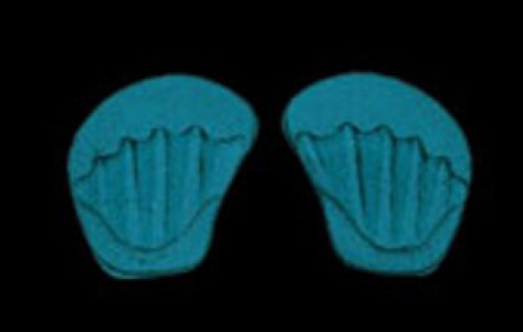 Soft Stride    Tender Foot Shoe Insert Medium Viscoelastic Polymer Male 6-1/2 to 10-1/2 / Female 7-1/2 to 11-1/2