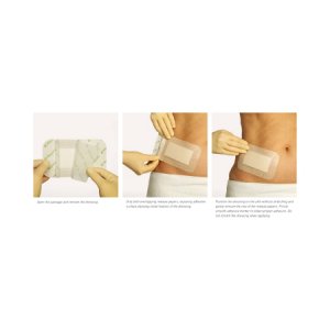 Adhesive Dressing Mepore   Pro 3.6 X 8 Inch Nonwoven / Film Rectangle Tan Sterile