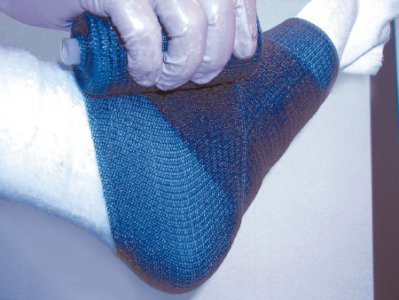 Cast Tape Delta-Lite   Plus 3 Inch X 12 Foot Fiberglass / Resin Light Blue