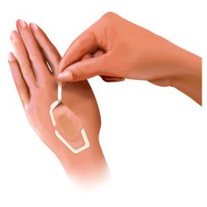 Adhesive Strip 3M Nexcare    7/8 X 1-1/16 Inch / 1-1/4 X 2-1/2 Inch / 1-1/16 X 2-1/4 Inch Plastic Rectangle Sheer Sterile