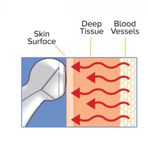 Temporal Contact Thermometer Adtemp    Temporal Probe Handheld