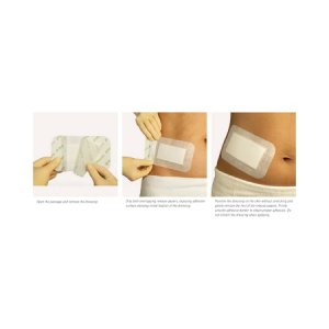 Adhesive Dressing Mepore   3-3/5 X 8 Inch Nonwoven Spunlace Polyester Rectangle White Sterile