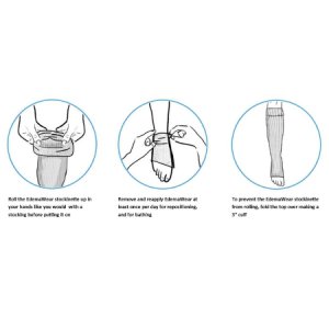 Compression Stockinette EdemaWear   X-Large White Foot to Groin