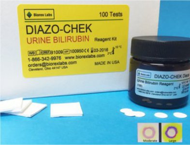 Test Kit DIAZO-CHEK Hepatic / General Chemistry Bilirubin Urine Sample 100 Tests CLIA Waived