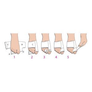 Bunion Splint Softsplint    Small Left Foot